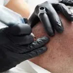 Scalp Micropigmentation (SMP)