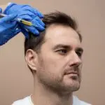 Platelet-Rich Plasma (PRP) Therapy