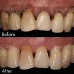 Periodontal Therapy