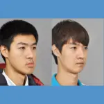 Mouth Protrusion Orthognatic S