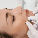 Profhilo