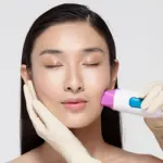 Thermage