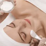 Acne Treatment