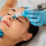Acne Scar/Pore Treatment​