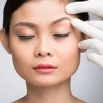 Eyebrow Lift